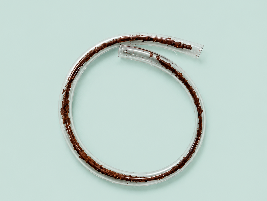 Ksharasutra — medicated surgical linen thread with Ayurvedic herbs
